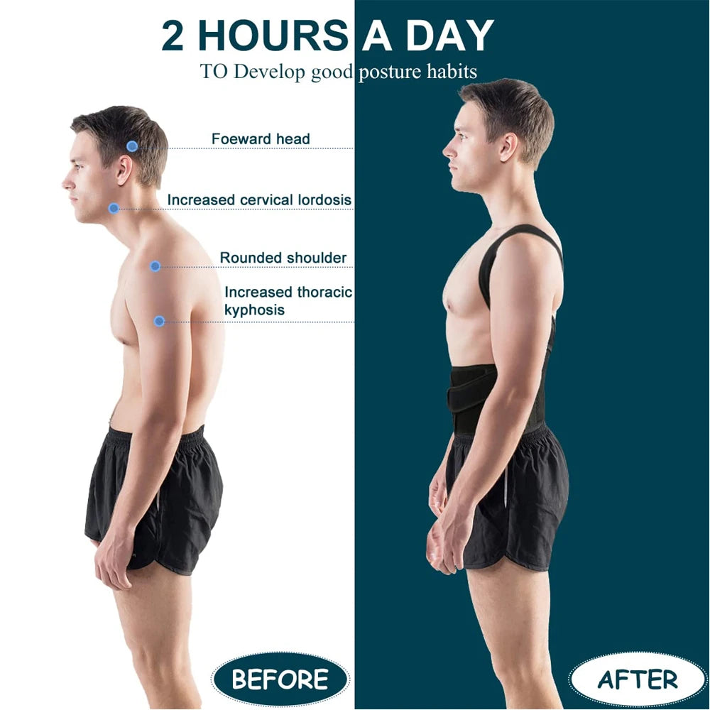 Adjustable Back Brace Posture Corrector for Men & Women