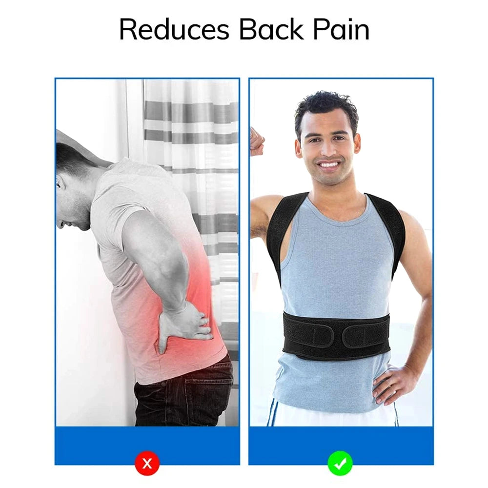 Adjustable Back Brace Posture Corrector for Men & Women