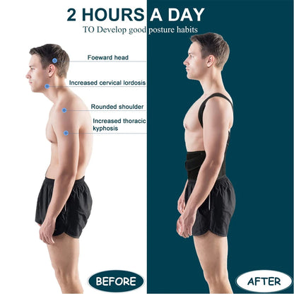 Adjustable Back Brace Posture Corrector for Men & Women